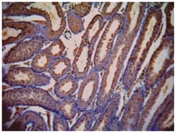 LDHC Goat anti-Mouse, Polyclonal Antibody, Abnova 100&mu;g; Unlabeled:Antibodies,