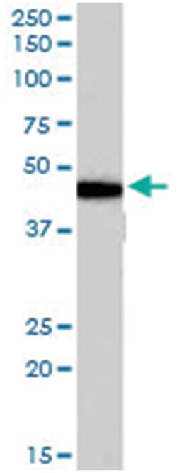 ADRB3, Goat, Polyclonal Antibody, Abnova 100 &mu;g | Buy Online | Abnova Corporation | Fisher Scientific