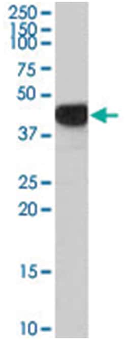 ASS1, Goat, Polyclonal Antibody, Abnova 100&mu;g; Unlabeled:Antibodies,