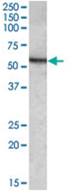 ARSA, Goat, Polyclonal Antibody, Abnova 100 &mu;g | Buy Online | Abnova Corporation | Fisher Scientific
