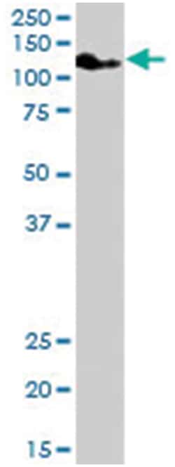 ATP13A1, Goat, Polyclonal Antibody, Abnova 100 &mu;g | Buy Online | Abnova | Fisher Scientific