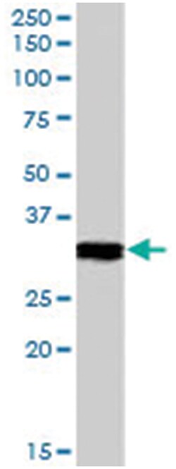 CLIC4, Goat, Polyclonal Antibody, Abnova 100 &mu;g | Buy Online | Abnova Corporation | Fisher Scientific