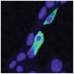 CLIC4, Goat, Polyclonal Antibody, Abnova 100 &mu;g | Buy Online | Abnova Corporation | Fisher Scientific