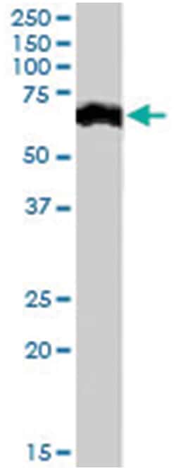 CRHR1 Goat anti-Human, Mouse, Polyclonal Antibody, Abnova 100&mu;g; Unlabeled:Antibodies,