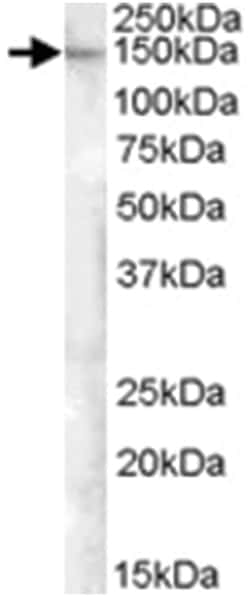 FAM62A, Goat, Polyclonal Antibody, Abnova 100&mu;g; Unlabeled:Antibodies,