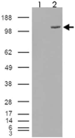 FAM62A, Goat, Polyclonal Antibody, Abnova 100&mu;g; Unlabeled:Antibodies,