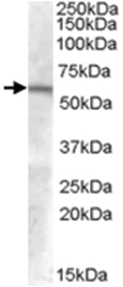 GCNT3 Goat anti-Human, Polyclonal Antibody, Abnova 100&mu;g; Unlabeled:Antibodies,