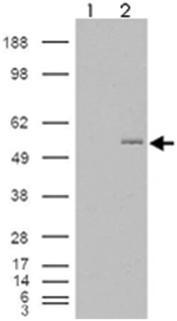 GCNT3 Goat anti-Human, Polyclonal Antibody, Abnova 100&mu;g; Unlabeled:Antibodies,