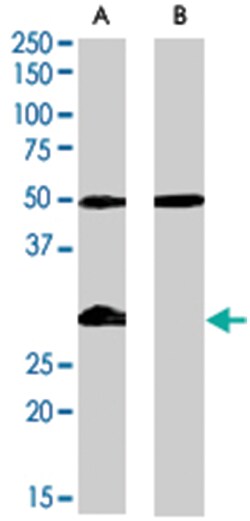 IGFBP3, Goat, Polyclonal Antibody, Abnova 100 &mu;g | Buy Online | Abnova | Fisher Scientific