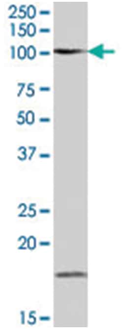 MARCH6. Goat anti-Human, Polyclonal Antibody, Abnova 100&mu;g; Unlabeled:Antibodies,
