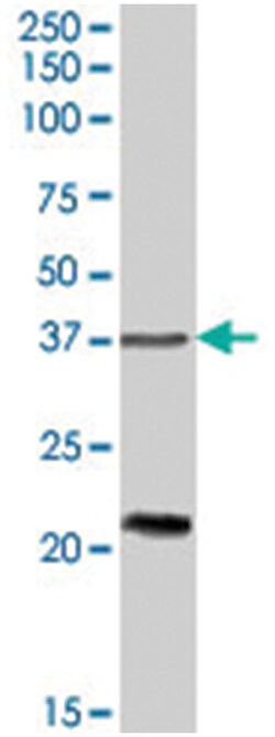 TUSC3, Goat, Polyclonal Antibody, Abnova 100&mu;g; Unlabeled:Antibodies,
