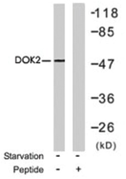 DOK2 Rabbit anti-Human, Polyclonal Antibody, Abnova 100&mu;g; Unlabeled:Antibodies,