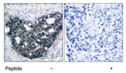 DOK2 Rabbit anti-Human, Polyclonal Antibody, Abnova 100&mu;g; Unlabeled:Antibodies,