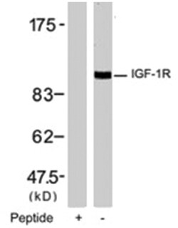 IGF1R Rabbit anti-Human, Mouse, Rat, Polyclonal Antibody, Abnova 100&mu;g;