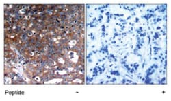 IGF1R Rabbit anti-Human, Mouse, Rat, Polyclonal Antibody, Abnova 100&mu;g;