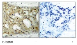 AR (phospho S650), Rabbit anti-Human, Polyclonal Antibody, Abnova 100&mu;g;