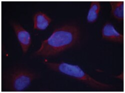 NOS3 (phospho S1177), Rabbit anti-Human, Mouse, Rat, Polyclonal Antibody, Abnova 100 &mu;L | Buy Online | Abnova | Fisher Scientific