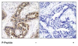 CDKN1A (phospho T145), Rabbit anti-Human, Polyclonal Antibody, Abnova 100&mu;g;