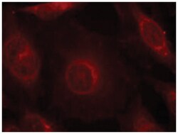 AKT1/AKT2/AKT3 (phospho Y315/Y316/Y312), Rabbit anti-Human, Mouse, Rat,