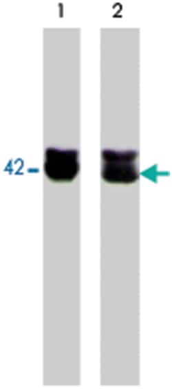 ACTB Rabbit anti-Chicken, Human, Mouse, Rat, Polyclonal Antibody, Abnova 100 &mu;L | Buy Online | Abnova | Fisher Scientific
