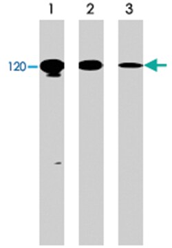 CDH1 Rabbit anti-Human, Mouse, Rat, Polyclonal Antibody, Abnova 100&mu;L;