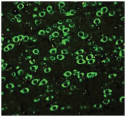 ABI1 Rabbit anti-Human, Mouse, Rat, Polyclonal Antibody, Abnova 100&mu;g;