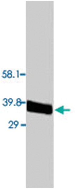 ANXA5 Rabbit anti-Human, Rat, Polyclonal Antibody, Abnova 100&mu;g; Unlabeled:Antibodies,