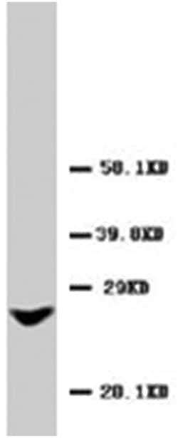 Gjb2, Rabbit, Polyclonal Antibody, Abnova 100&mu;g; Unlabeled:Antibodies,