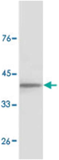 GJA1 Rabbit anti-Human, Mouse, Rat, Polyclonal Antibody, Abnova 100&mu;g;