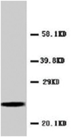 CRP Rabbit anti-Human, Polyclonal Antibody, Abnova 100&mu;g; Unlabeled:Antibodies,