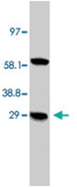 BNIP3 Rabbit anti-Human, Mouse, Rabbit, Rat, Polyclonal Antibody, Abnova