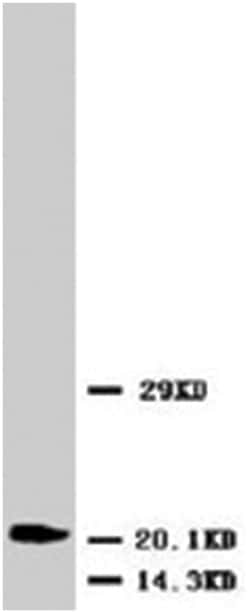 ENO2 Rabbit anti-Human, Mouse, Rabbit, Rat, Polyclonal Antibody, Abnova