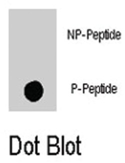 PAK1 (phospho T423), Rabbit anti-Human, Polyclonal Antibody, Abnova 400&mu;L;