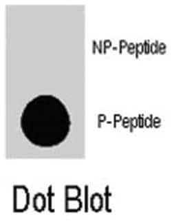 phospho-TSC2 S1798, Rabbit, Polyclonal Antibody, Abnova 400&mu;L; Unlabeled:Antibodies,