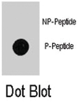 MAP1LC3B (phospho T12), Rabbit anti-Human, Polyclonal Antibody, Abnova