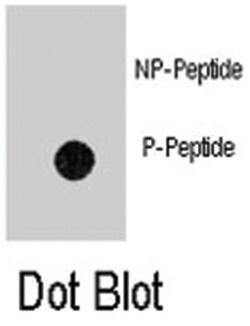ANTXR1 (phospho Y382), Rabbit anti-Human, Polyclonal Antibody, Abnova 400 &mu;L | Buy Online | Abnova Corporation | Fisher Scientific