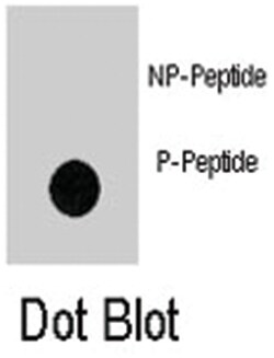 GIT1 (phospho Y554), Rabbit anti-Human, Polyclonal Antibody, Abnova 400&mu;L;