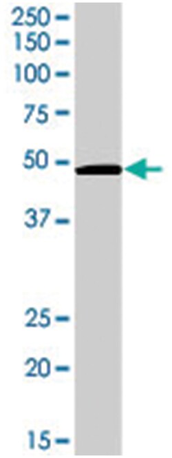 AKT2 (phospho S474), Rabbit anti-Human, Mouse, Rat, Polyclonal Antibody,