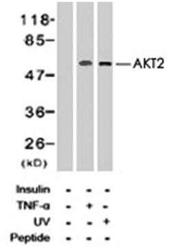 AKT2 (phospho S474), Rabbit anti-Human, Mouse, Rat, Polyclonal Antibody,