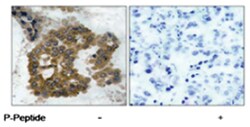 AKT2 (phospho S474), Rabbit anti-Human, Mouse, Rat, Polyclonal Antibody,