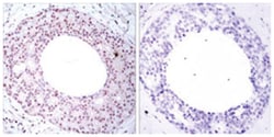 RELA (phospho T254), Rabbit anti-Human, Mouse, Rat, Polyclonal Antibody,