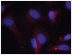 ZAP70 (phospho Y319), Rabbit anti-Human, Mouse, Rat, Polyclonal Antibody,