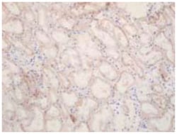 SLC22A7, Rabbit, Polyclonal Antibody, Abnova 25&mu;g; Unlabeled:Antibodies,