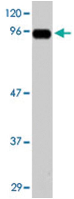 Ppp2r3c, Rabbit, Polyclonal Antibody, Abnova 25 &mu;g | Buy Online | Abnova Corporation | Fisher Scientific