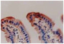 SLC12A8 Rabbit anti-Mouse, Polyclonal Antibody, Abnova 25&mu;g; Unlabeled:Antibodies,