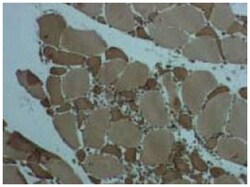 CKLF, Rabbit, Polyclonal Antibody, Abnova 25 &mu;g | Buy Online | Abnova | Fisher Scientific