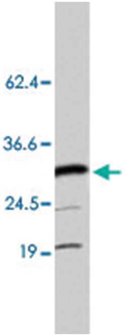 Hmgb3, Rabbit, Polyclonal Antibody, Abnova 25&mu;g; Unlabeled:Antibodies,