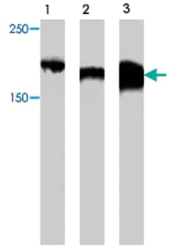 Zbtb38, Rabbit, Polyclonal Antibody, Abnova 100&mu;g; Unlabeled:Antibodies,
