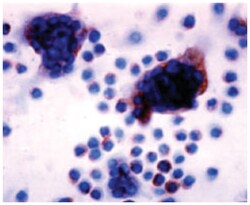 Tm7sf4, Rabbit, Polyclonal Antibody, Abnova 25 &mu;g | Buy Online | Abnova | Fisher Scientific