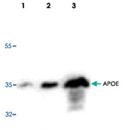 APOE Rabbit anti-Human, Polyclonal Antibody, Abnova 100&mu;g; Unlabeled:Antibodies,